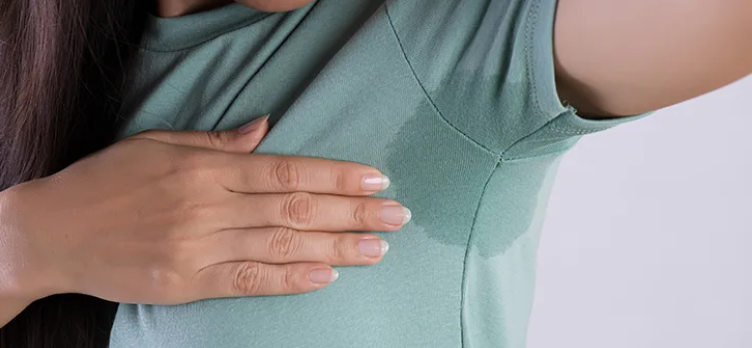 Worried about excessive sweating? Here's what you need to know
