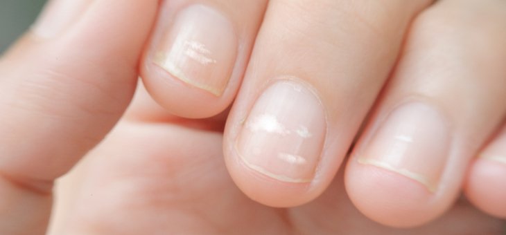 What your nails say about you | YourLifeChoices