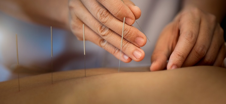 Podcast: All you need to know about Chinese medicine and acupuncture