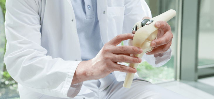 doctor showing model of prosthetic knee replacement
