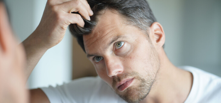 Surprising causes of hair loss you may not have factored in
