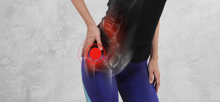 woman with hand on hip with overlay of hip bones