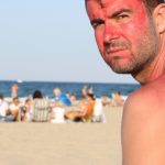 sunburnt man sitting on beach with frowny face of sunscreen on back