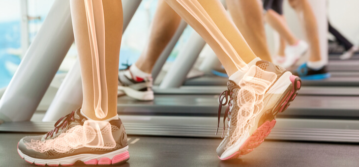 womans legs on treadmill with bones highlighted
