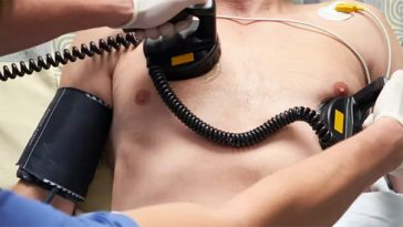 doctor applying defribulators to a mans chest