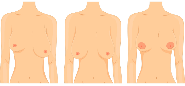Women's different shaped breasts