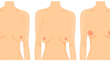 Women's different shaped breasts