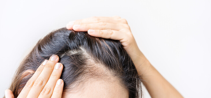 Hair loss: Why it happens and what can be done
