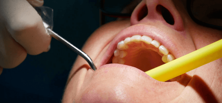 person having teeth examined by dentist