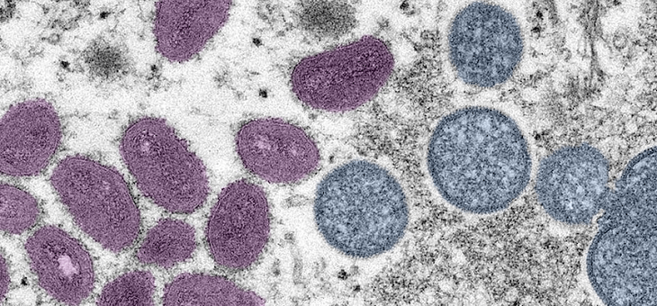 virus cells under microscope