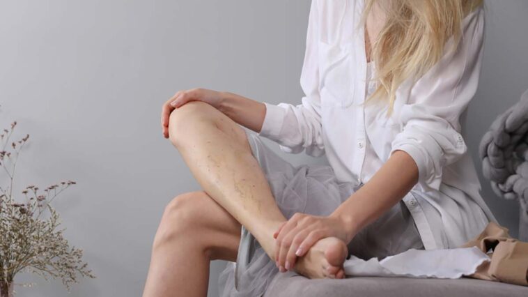 woman looking at her legs considering Me Clinic varicose vein removal