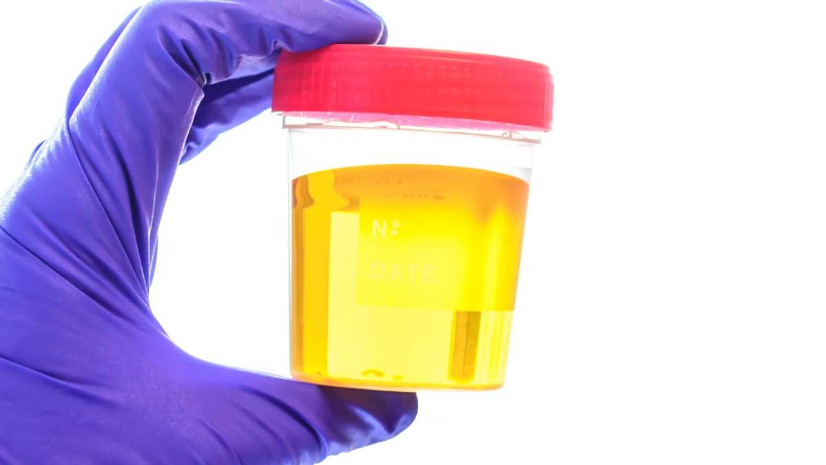 gloved hand holding urine sample