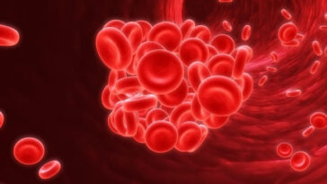 blod clot