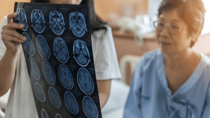 Brain disease diagnosis with medical doctor diagnosing elderly ageing patient neurodegenerative illness problem seeing Magnetic Resonance Imaging (MRI) film for neurological medical treatment