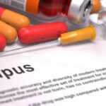 Lupus