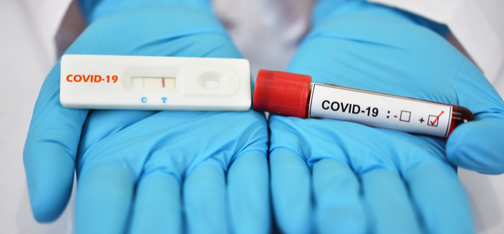 Beware of dodgy COVID-19 home-testing kits