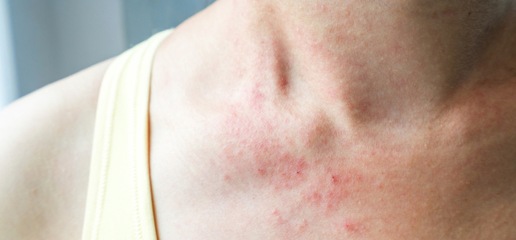 Is your skin rash life-threatening?