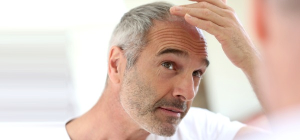 How to prevent male hair loss